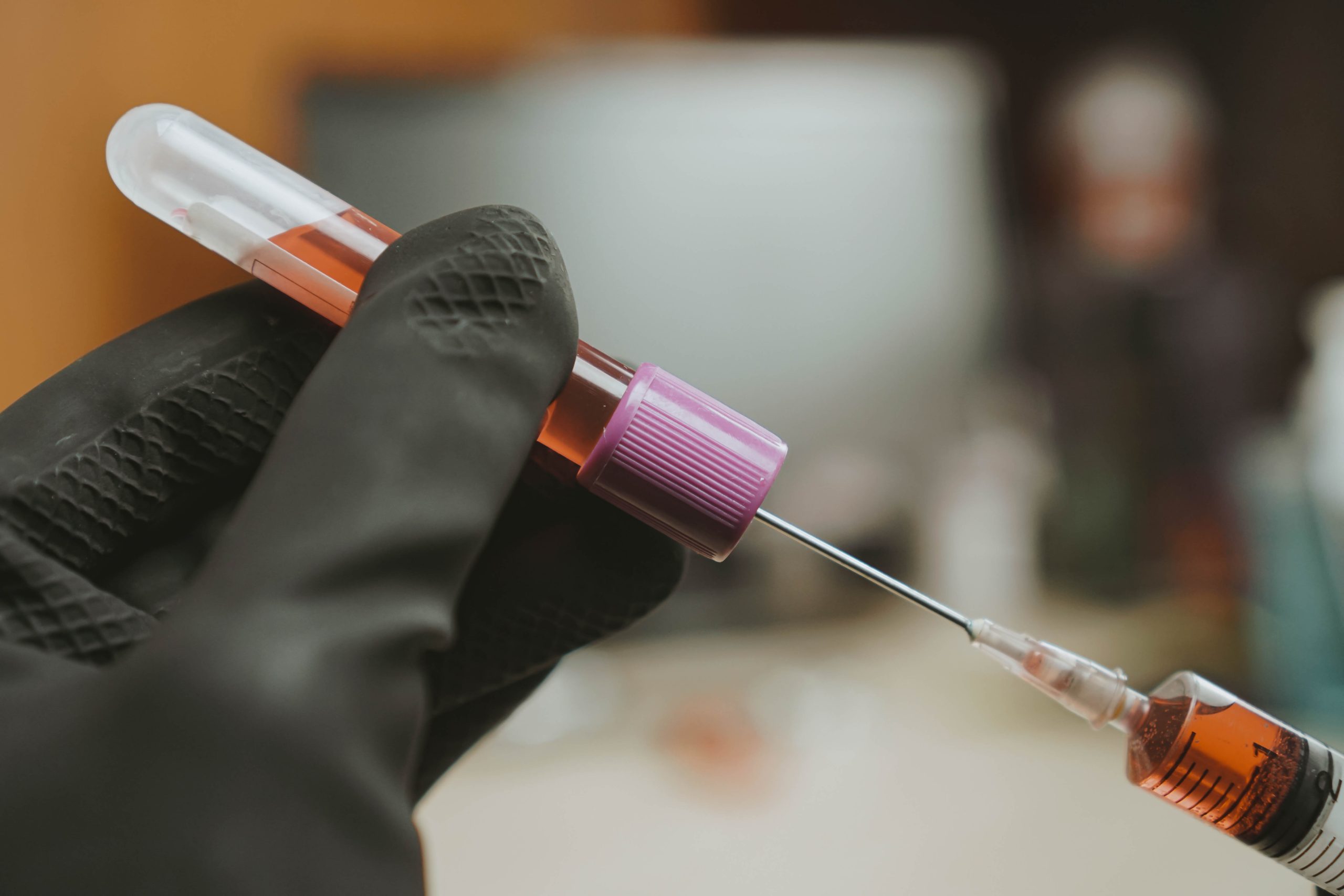 عيادة التجميل والليزر البلازما الغنية بالصفائح (PRP)
